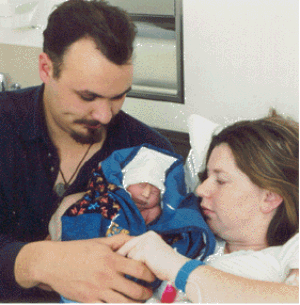 Benedict, baby with Anencephaly