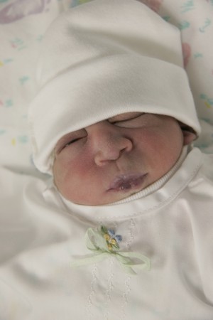 Clara Isabelle, baby with anencephaly