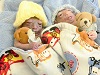 Matthew and Noah, twins with anencephaly