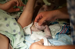 Olivia-Elise, baby with anencephaly