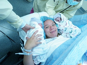 Oran and Jude, identical twins discordant for anencephaly