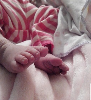 Victoria, bebé con anencefalia