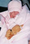 Amanda, baby with anencephaly