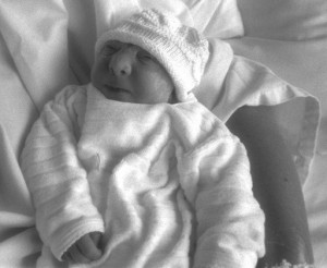 Anouk, baby in Anenzephalie