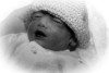 Austin John, baby with anencephaly