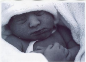 Benedict, baby in Anencephalie