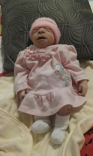 Bethani Beryl, baby with anencephaly