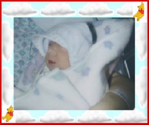 Brandon, bebe atteint d'anencephalie