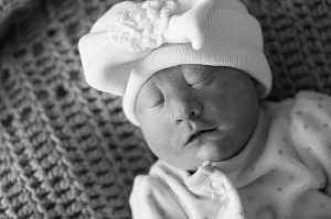 Brigid Valentine, baby with anencephaly