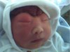Carmen Arviansyah, baby with anencephaly