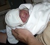 Christina, Baby mit Anenzephalie