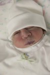 Clara, baby with anencephaly