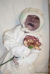 Dorian Gabriel, baby born with anencephaly