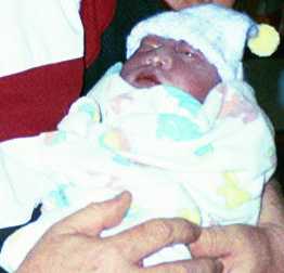 Emily Rose, baby in Anenzephalie