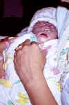 Emily Rose, baby in Anencephalie