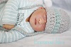 Emmanuel John, baby with anencephaly