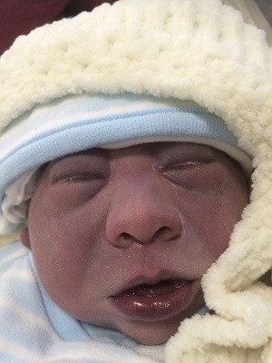 Ethan David, baby with anencephaly