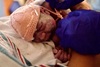 Everly Jo, baby with anencephaly