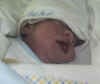 Fabian Alejandro, bebé con anencefalia