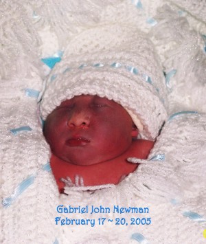 Gabriel John Newman, baby with anencephaly