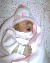 Gianna Faith-Dawn, baby with anencephaly