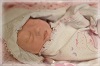 Gracelyn, baby with anencephaly