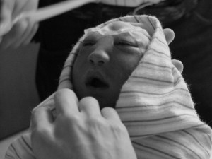 Gracie Lynn, baby with anencephaly