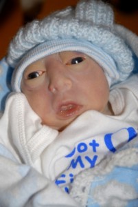 Grayson, baby with anencephaly