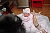 Heavenly Ann, baby with anencephaly