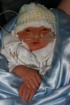 Isaac Ayden, baby with anencephaly