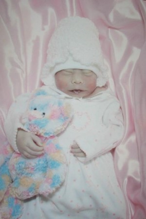 Jenna Grace, Baby mit Anenzephalie