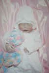 Jenna Grace, baby in Anencephalie