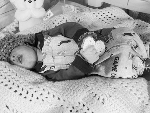 John Joseph, baby with anencephaly