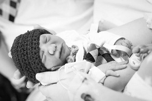 Joshua, baby with anencephaly