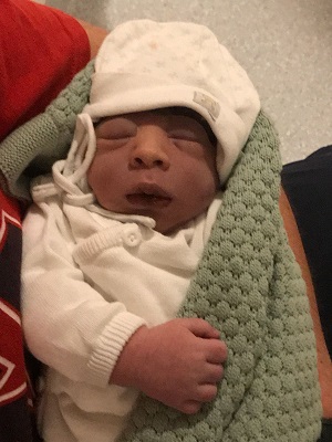 Joshua Philip, baby with anencephaly