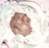 Joyann, baby with anencephaly