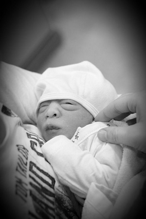 Juda, Baby in Anenzephalie