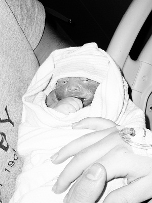 Kassidy Briana, baby with anencephaly