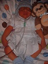 Konnor, baby with anencephaly