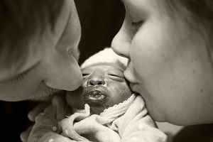 Kyra Jean, baby with anencephaly