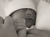 Luca, baby met anencephalie