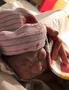 Luna Faith, baby with anencephaly