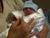Malachi Samuel, baby with anencephaly