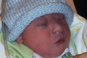 McCoy, baby with anencephaly