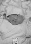 Michael David, baby with anencephaly