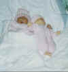 Michaela Hope, baby in Anencephalie