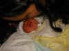 Pedro Jose, bebé con anencefalia