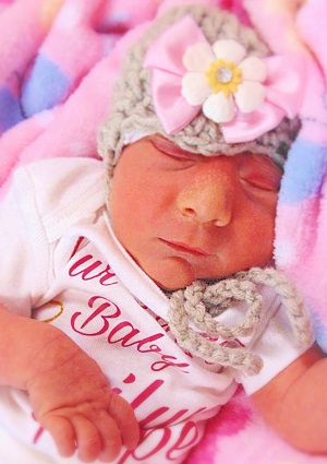Railyn Hope, baby with anencephaly