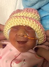 Railyn Hope, baby with anencephaly