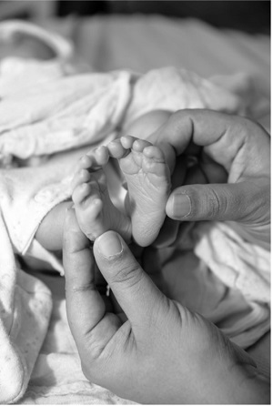 Ruhee, baby with anencephaly